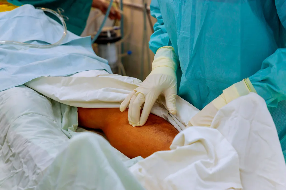 Cirugía de trauma vascular y salvamento de extremidad en Querétaro: Atención especializada para preservar la circulación y la extremidad afectada